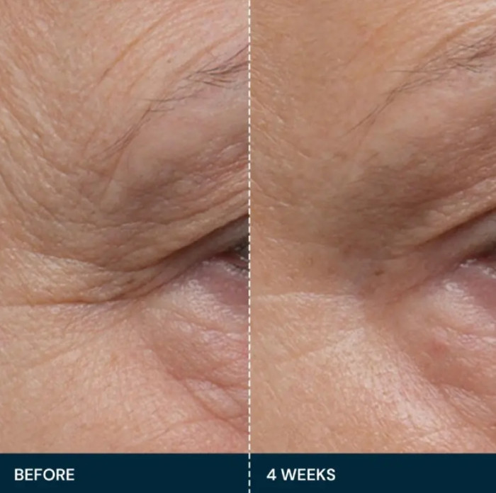 Совершенная укрепляющая сыворотка Про-Коллаген ELEMIS Pro Collagen Future Restore Serum, 30 мл