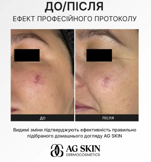 Сосудоукрепляющая сыворотка AG SKIN ANTI-REDNESS SERUM, 30 мл