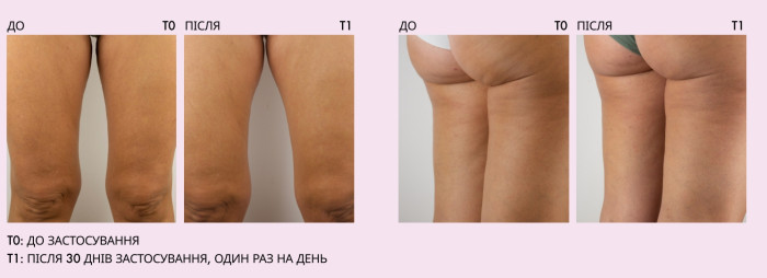 Омолаживающий крем для тела с микробиом Rhea AgeFree[mi], 200 мл