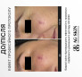 Сосудоукрепляющая сыворотка AG SKIN ANTI-REDNESS SERUM, 30 мл